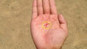 Box Mark On Palm