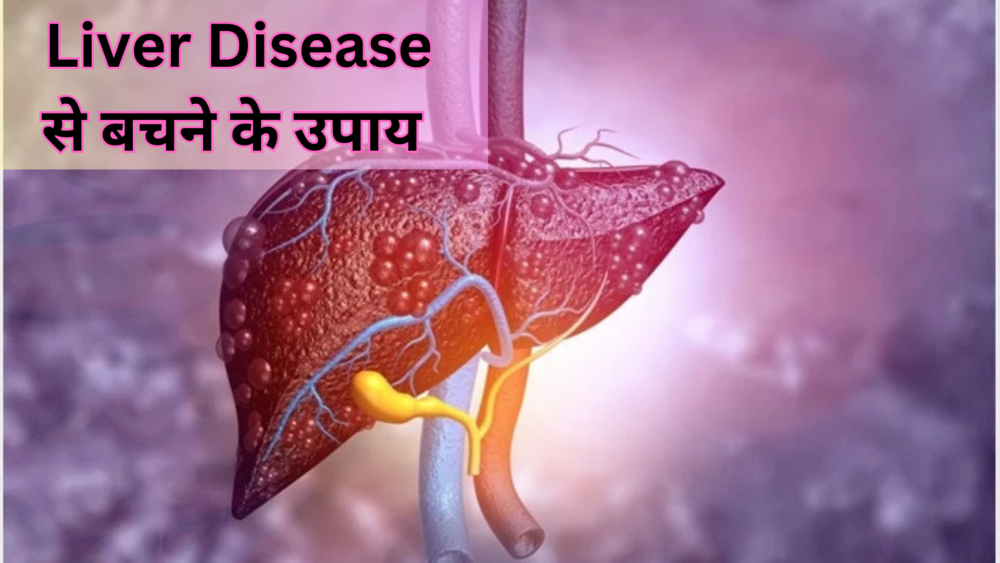 Liver Disease: