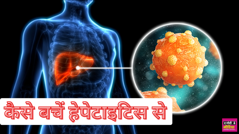 Hepatitis